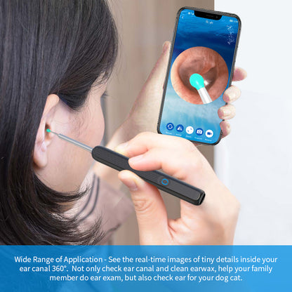 Clear Sight Wireless Ear Endoscope